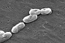 Sự thật kinh hoàng về loại vi khuẩn “ăn thịt người” đang hoành hành trở lại