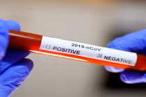 Bộ Y tế thông tin mới nhất về 3 ca bệnh COVID-19 nặng: Nhiều tín hiệu khả quan