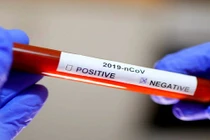 Bộ Y tế thông tin mới nhất về 3 ca bệnh COVID-19 nặng: Nhiều tín hiệu khả quan