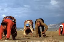 Những trường hợp dị dạng kỳ lạ của con người