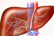 Những triệu chứng ung thư gan