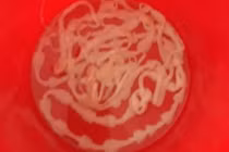 Xổ thành công sán xơ mít dài 8m sống trong cơ thể bệnh nhân