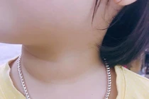 Bé trai 2 tuổi suýt chết vì đeo dây chuyền: rủi ro khi cho trẻ đeo trang sức