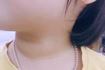 Bé trai 2 tuổi suýt chết vì đeo dây chuyền: rủi ro khi cho trẻ đeo trang sức