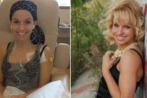 Người đẹp Mỹ chống chọi ung thư buồng trứng hiếm 