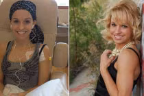 Người đẹp Mỹ chống chọi ung thư buồng trứng hiếm 