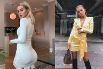 Lý do kinh khủng nào khiến nữ ca sĩ nổi tiếng tháo bỏ túi độn mông?