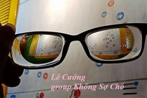 Ngỡ ngàng câu chuyện của chàng trai cận 19 độ đeo "kính lúp"