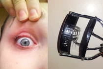 Những thảm họa làm đẹp khiến chị em sợ tới già