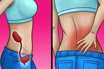 Những dấu hiệu cho thấy thận bạn đang có vấn đề