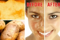 8 công thức mặt nạ tự nhiên giúp da mặt sáng mịn