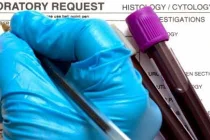 Phát hiện ung thư bằng xét nghiệm máu