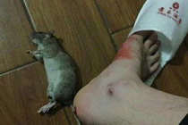 Sốc nặng chuột cắn chảy máu chân khách trong khách sạn hạng sang
