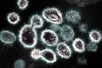 Thêm 31.787 ca mắc Covid-19, Hà Nội có 3.972 F0