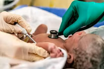 Loại ung thư khiến 1,8 triệu người tử vong hàng năm