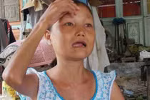 Cô gái 28 tuổi già như bà lão và ăn khỏe như lực sỹ