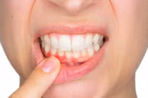 Điều gì xảy ra nếu bạn không đánh răng hàng ngày?