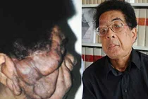 Những ca phẫu thuật khó tin trong lịch sử