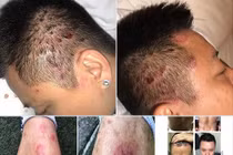 Phòng tránh bệnh quái ác ca sĩ Tuấn Hưng đang mắc phải thế nào?