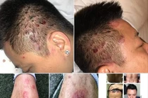 Phòng tránh bệnh quái ác ca sĩ Tuấn Hưng đang mắc phải thế nào?