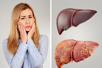 10 dấu hiệu cảnh báo cơ thể cần giải độc ngay và luôn