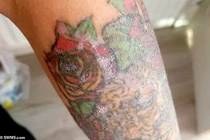 Hình ảnh rợn người khi phá bỏ hình xăm