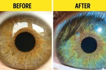 Bất ngờ những yếu tố có thể thay đổi màu mắt