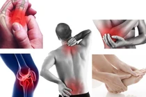 Những thực phẩm tuyệt đối tránh nếu bị viêm xương khớp