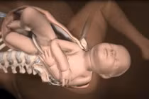 Thai bị kẹt vai và nguyên nhân khiến bác sĩ phải “mạnh tay” kéo đứt cổ trẻ?