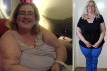 Tăng cân khủng khiếp vì khối u ẩn chết người