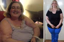 Tăng cân khủng khiếp vì khối u ẩn chết người