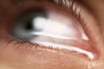 Cảnh giác với những nguyên nhân khiến bạn chảy nước mắt không kiểm soát