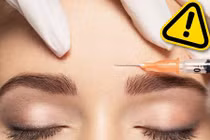 Cân nhắc thật kỹ trước khi làm đẹp bằng những phương pháp đang hot này