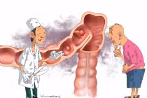 Ung thư đại trực tràng có di truyền không?