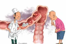 Ung thư đại trực tràng có di truyền không?