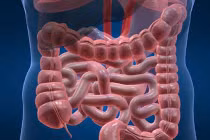 Ung thư đại trực tràng: Người trẻ tuổi cũng có thể mắc