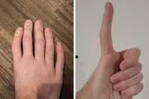 Kinh ngạc những bộ phận cơ thể bất thường của con người