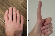 Kinh ngạc những bộ phận cơ thể bất thường của con người