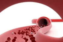 Bạn sẽ gặp vấn đề sức khỏe nghiêm trọng nào khi thiếu vitamin K?