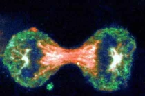 Tầm soát giảm 70% nguy cơ ung thư tử cung 