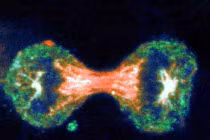 Tầm soát giảm 70% nguy cơ ung thư tử cung 