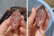 Kinh hoàng cá nhiễm sán khiến bà nội trợ hoang mang