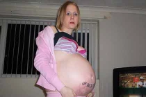 Bụng to như bà bầu sắp sinh vì bị phình đại tràng