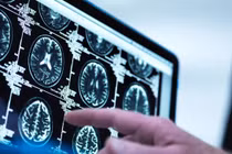 Người đau xương khớp 'tránh xa' những thực phẩm này