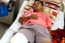 Cầu cứu Bộ trưởng Y tế khi bị cưa chân do BS chẩn đoán nhầm