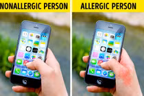 11 vật dụng quen thuộc hàng ngày có thể âm thầm khiến bạn dị ứng