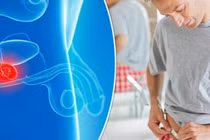 Ung thư tuyến tiền liệt, ai có nguy cơ cao dễ mắc bệnh? 