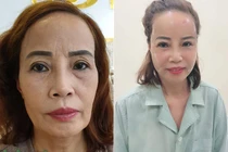 Cận cảnh nhan sắc của cô dâu 62 tuổi sau khi đại tu sắc đẹp
