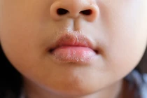 10 thay đổi cơ thể cảnh báo bệnh tật nguy hiểm bạn cần chú ý