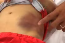 Xót xa những vụ cha mẹ bạo hành chính con ruột gây “nóng” dư luận